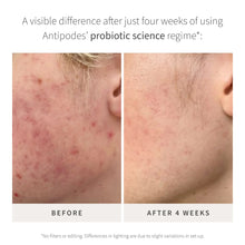 Carica l'immagine nel visualizzatore di Gallery, Credo Probiotic Anti-Blemish Serum 30ml